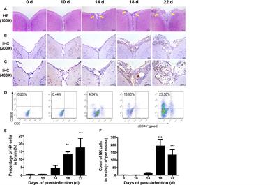 CX3CL1 Recruits NK Cells Into the Central Nervous System and Aggravates Brain Injury of Mice Caused by Angiostrongylus cantonensis Infection